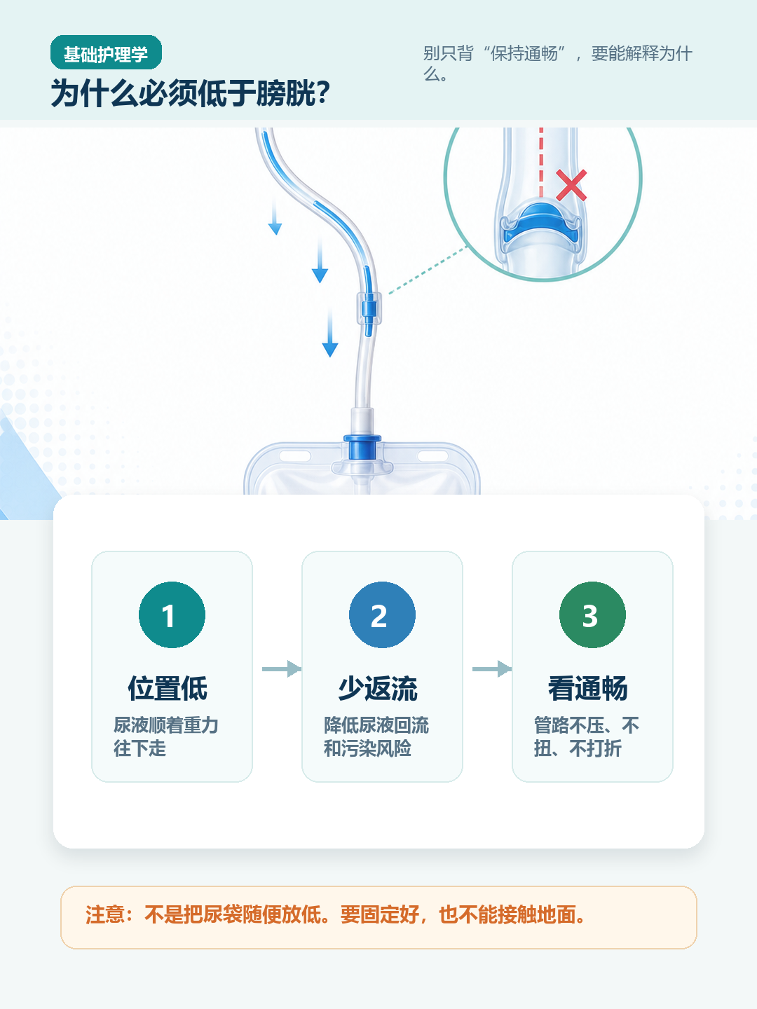 尿袋为什么要低于膀胱